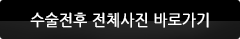 수술전후 전체사진 바로가기