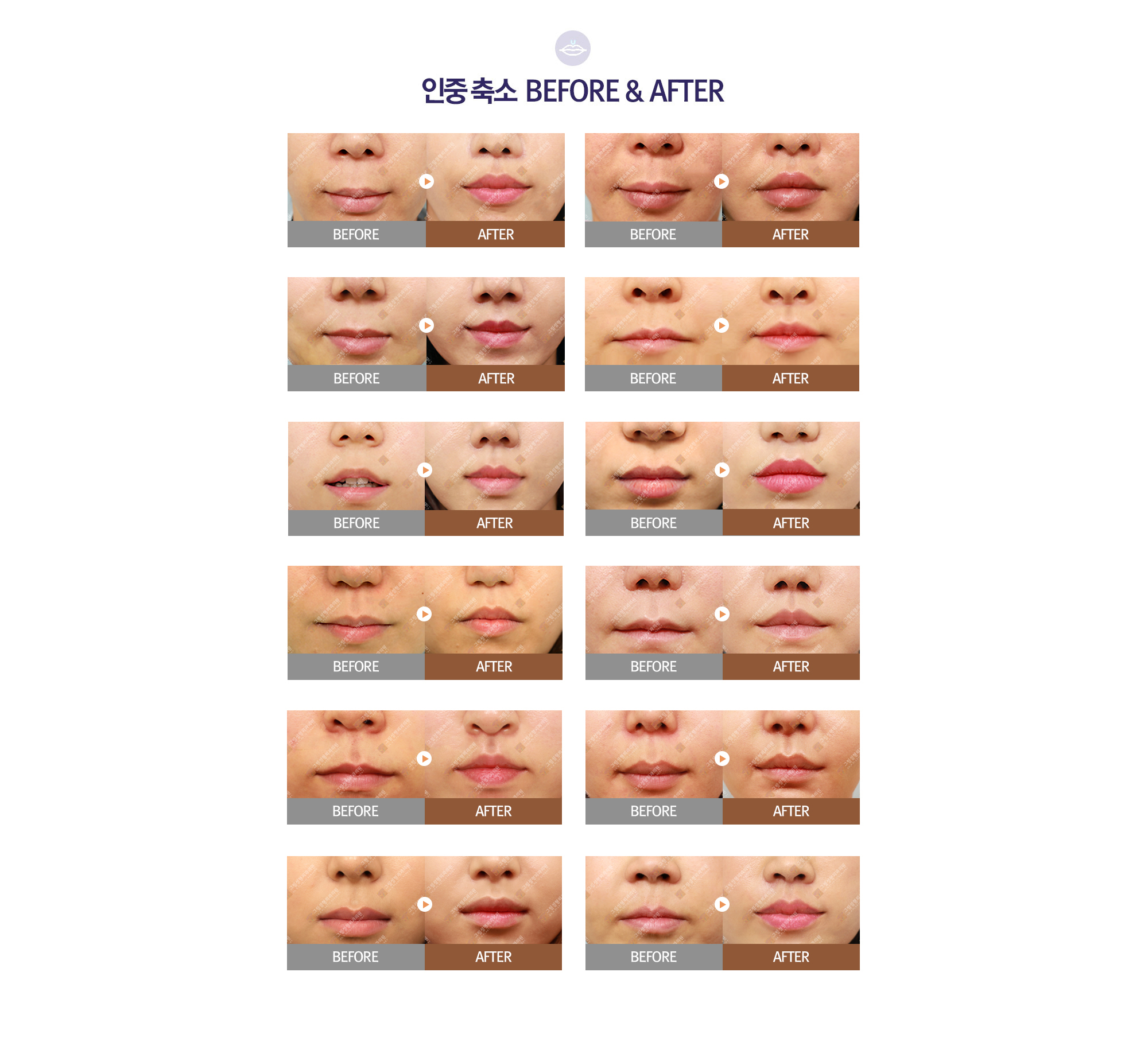  BEFORE & AFTER.