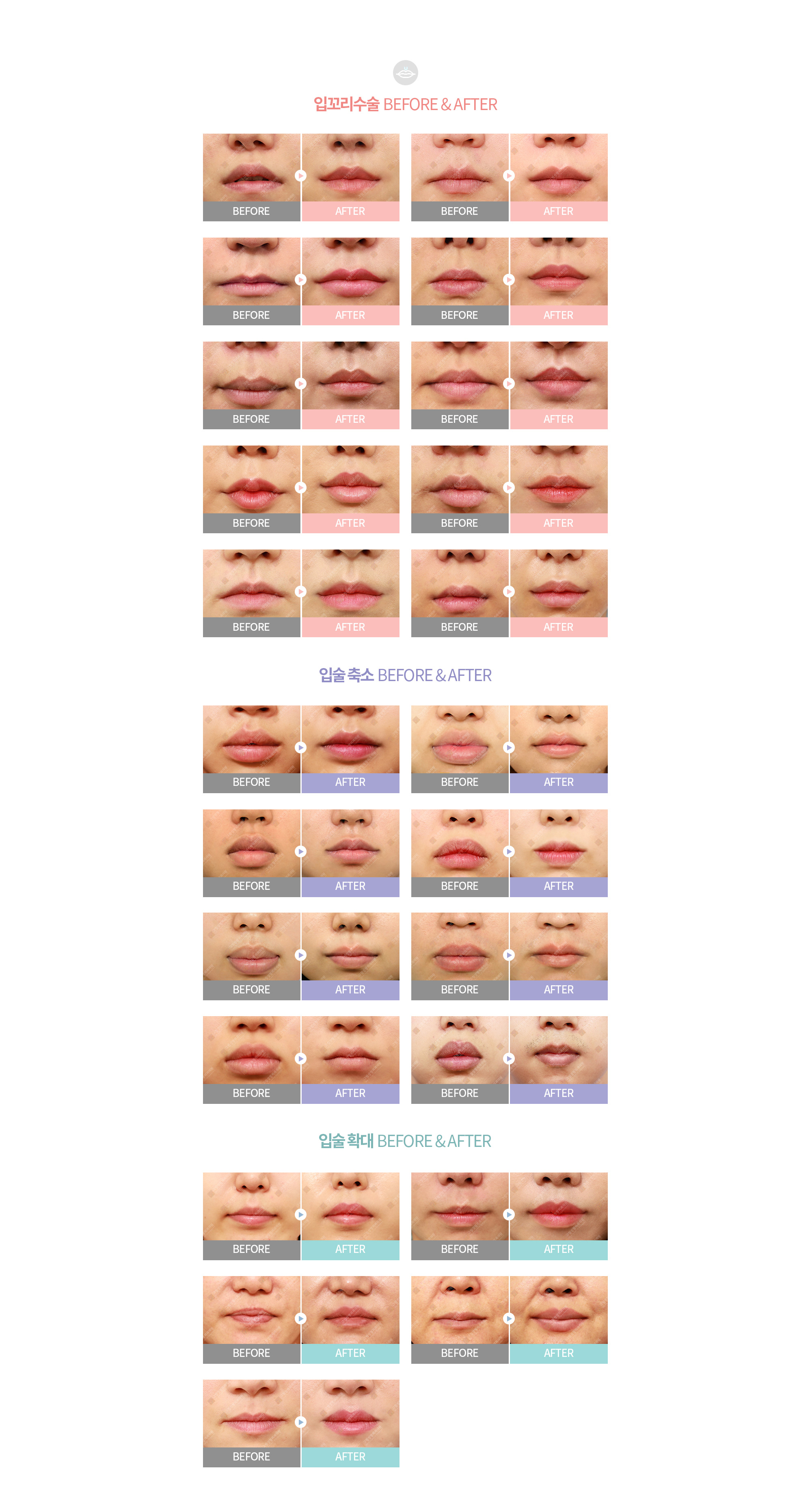BEFORE & AFTER